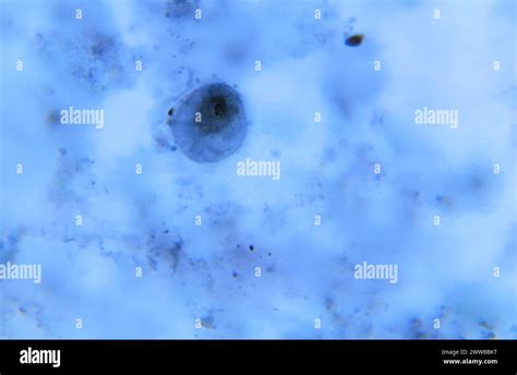  Dientamoeba Fragilis: Które Złote Zasady Przestrzega To Małe Zwierzątko Występujące Wjelu Osobników Na Całym Świecie?