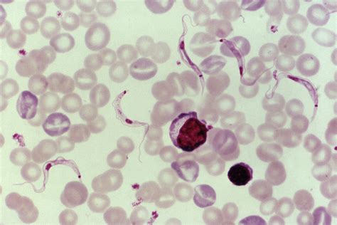  Trypanosoma! A Tiny Parasite With Big Implications For Human Health